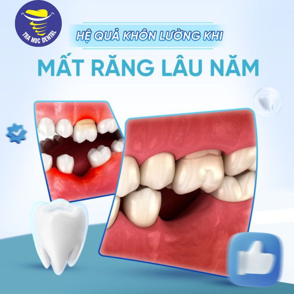 Hậu Quả Của Mất Răng Lâu Năm Và Tầm Quan Trọng Của Việc Điều Trị Sớm