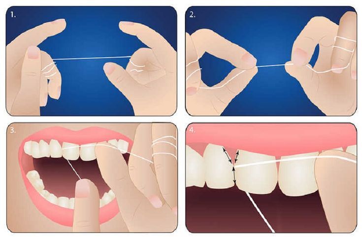 Sử dụng chỉ nha khoa đúng cách: 5 bước đơn giản ai cũng làm được